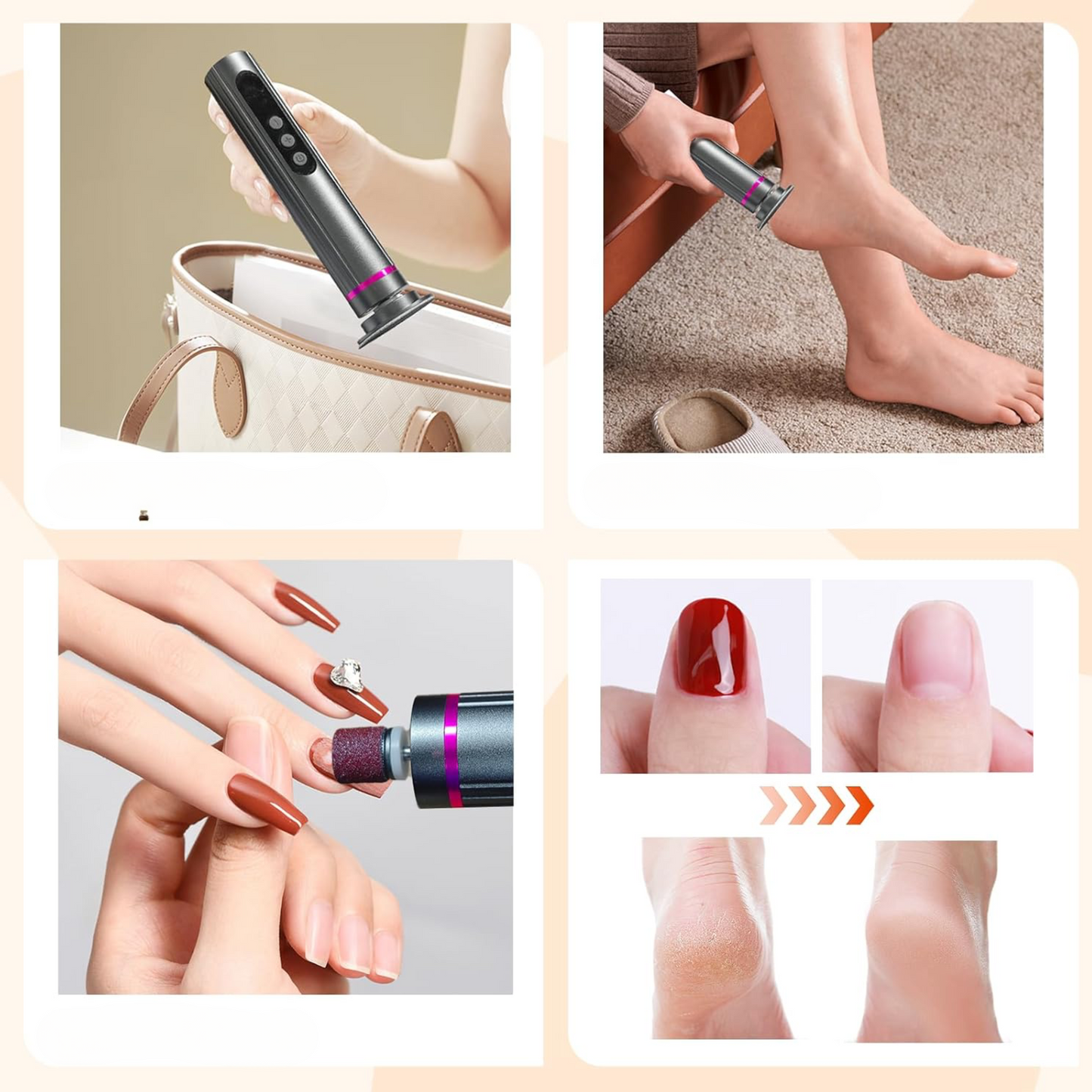 VelvaFeet™ – Electric Callus Remover